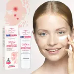 Aichun Beauty Anti-freckle Cream