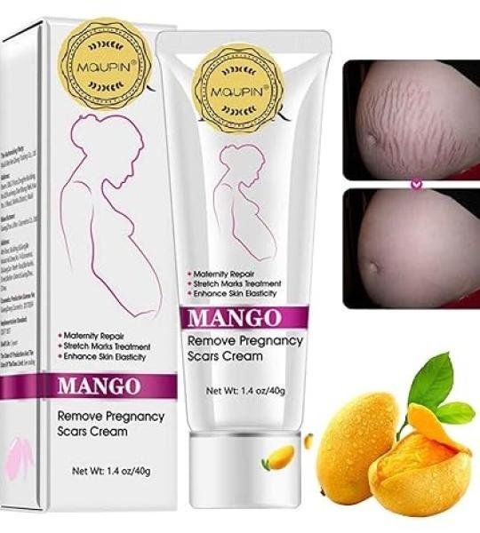 Rtopr Mango Remove Pregnancy Scars Cream